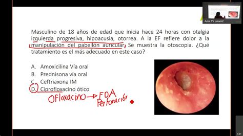 otorrinos en osorno|OTORRINOLARINGOLOGÍA